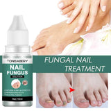 Nail Fungus Remover